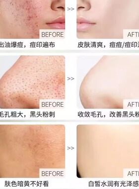 儿童洗面奶温和不刺激保湿控油