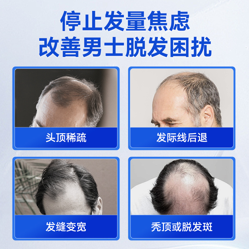 Hanmi韩美药品米诺地尔3%女性专研生发液医院同款增发密发治脱发