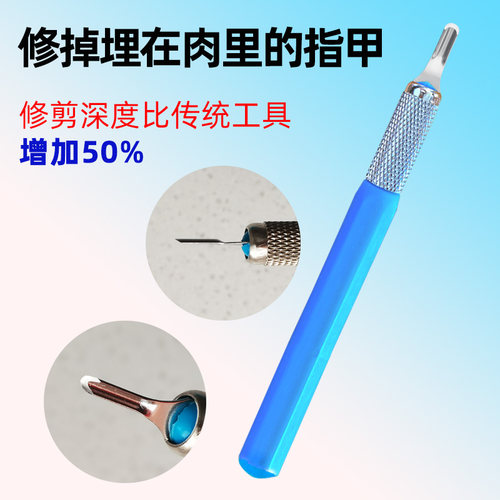 德国U型甲沟焱炎修甲刀指甲修脚工具家用指甲扎肉嵌甲修脚刀神器 - 图3