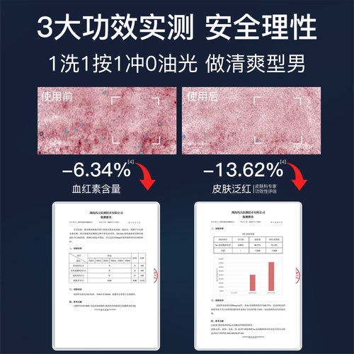 尊界男士氨基酸控油洗面奶深层清洁温和去黑头收敛毛孔清爽洁面乳 - 图1
