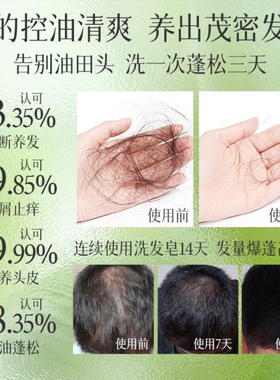亓墨茶枯茶麸侧柏叶养发皂洗头发养发防断发控油去屑蓬松手工皂