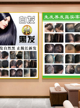 【新款特惠】头疗图片宣传画