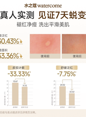 水之蔻果酸沐浴露洗发水旅行装持久留香控油蓬松祛痘女男士