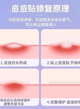 星星水胶体遮瑕祛痘贴