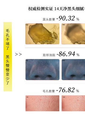 【毛孔粗大】【 控油净颜】Froms毛孔黑头净肤霜紧致毛孔官方正品