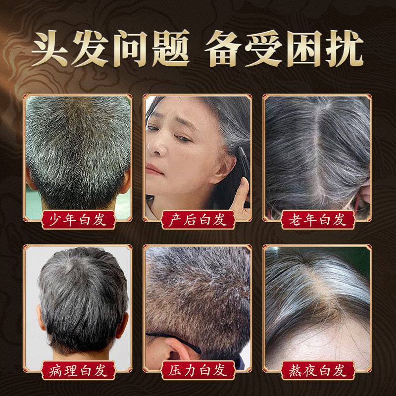 香港大药房乌参育发丸根源内调白发脱发白转黑生发草本制品,淘宝优惠券,粉丝福利购,淘宝优惠卷