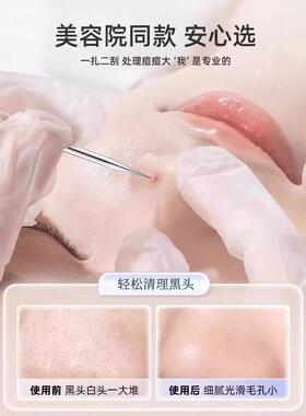 【赠送收纳盒】美容店专用细胞夹美容针粉刺夹粉刺针黑头痘痘针