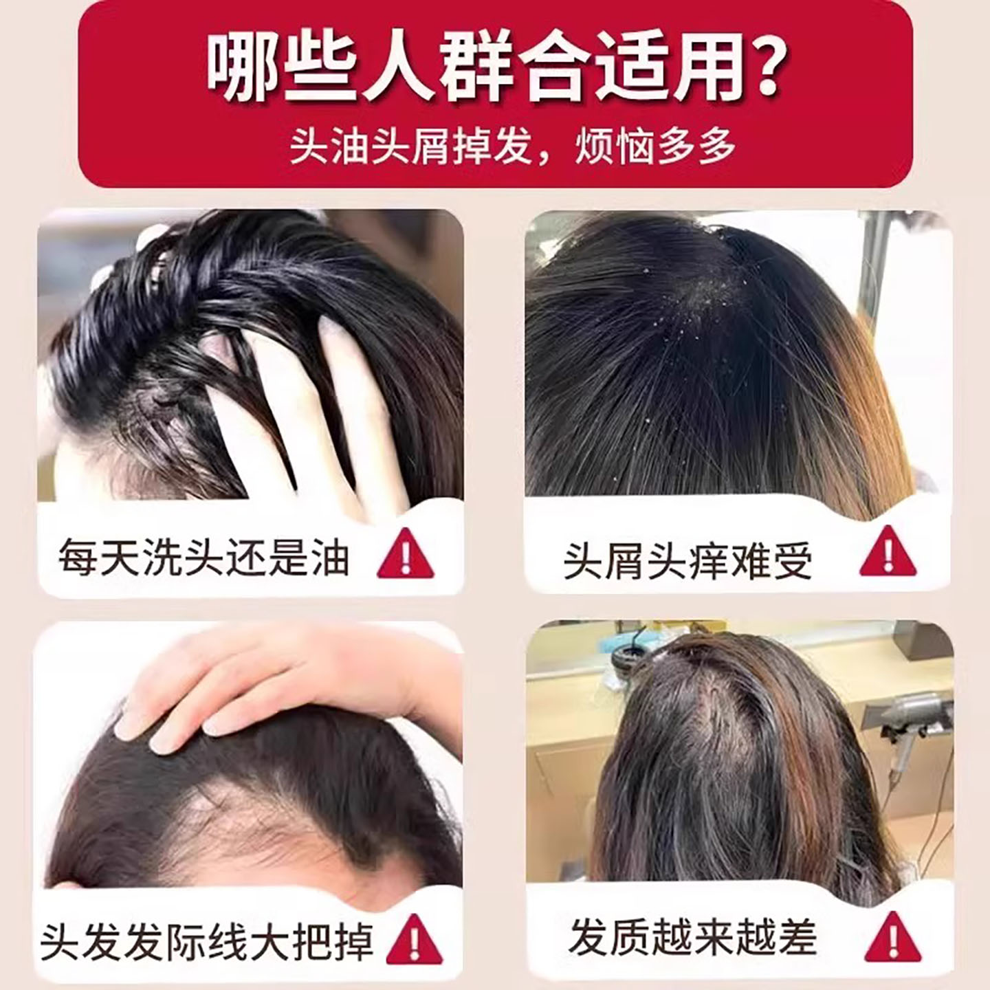 【天然草本洗发皂】何首乌洗头洗发皂侧柏叶皂角控油养发苗家古皂 - 图2