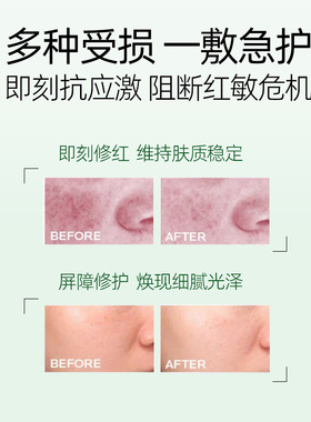 【低价尝鲜】freemay积雪草安瓶面膜舒缓修护滋润补水泛红修复4片