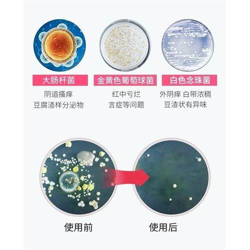 红霉素软丽尔维美私处女性消红肿疙瘩外阴瘙痒止痒消红肿祛异味 - 图1