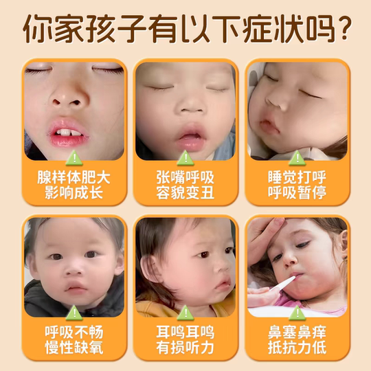 Qing Adenoid Adenoid Hypertrophy Chinese Medicine Apply for Children to regulate facial correction tonsill hypertrophy