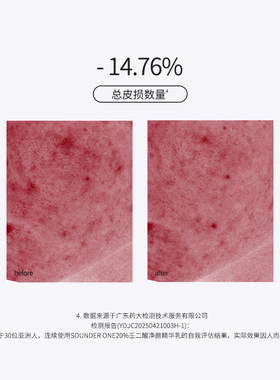 Sounder One20%壬二酸密集焕颜乳霜祛痘控油舒缓SOUNDER ONE