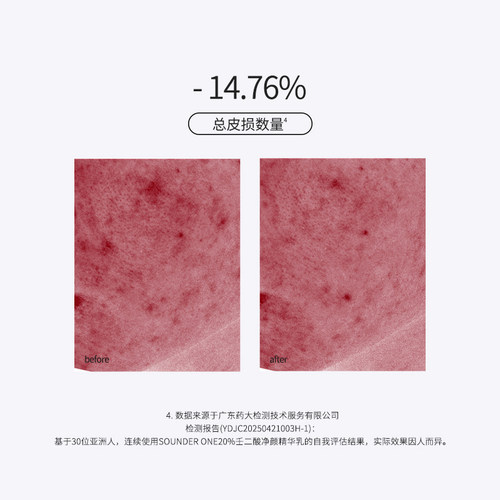 Sounder One20%壬二酸密集焕颜乳霜祛痘控油舒缓SOUNDER ONE - 图1