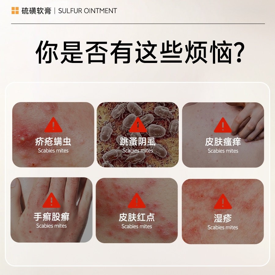 含20%硫磺软膏官方正品去虱螨虫阴囊疥虫皮肤外用温和抑菌膏非药,淘宝优惠券,粉丝福利购,淘宝优惠卷