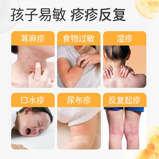 【敏皮拜拜】宝体安新升级皮肤益生菌2小时舒缓皮敏换季皮肤养护