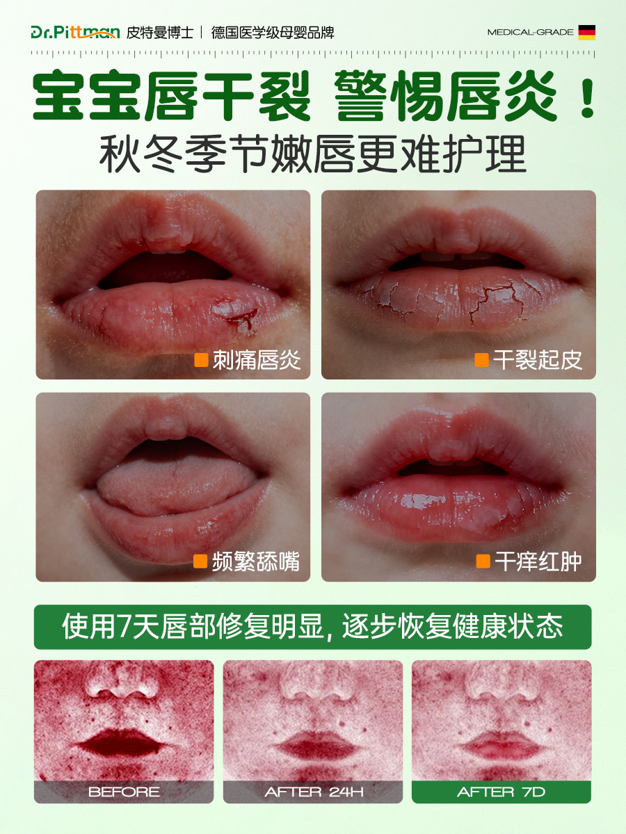 儿童润唇膏唇炎嘴唇防干裂脱皮滋润保湿小男女孩专用食品级无添加,淘宝优惠券,粉丝福利购,淘宝优惠卷