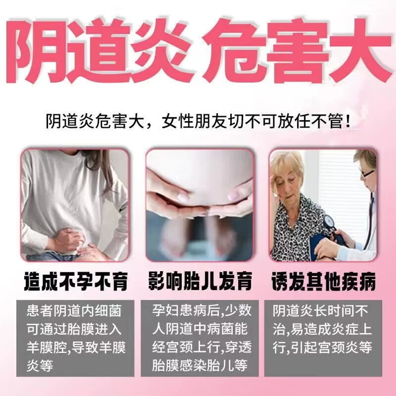双唑泰栓阴凝胶甲硝唑栓剂炎症性消炎药瘙痒症妇科外阴瘙痒专用药 - 图1