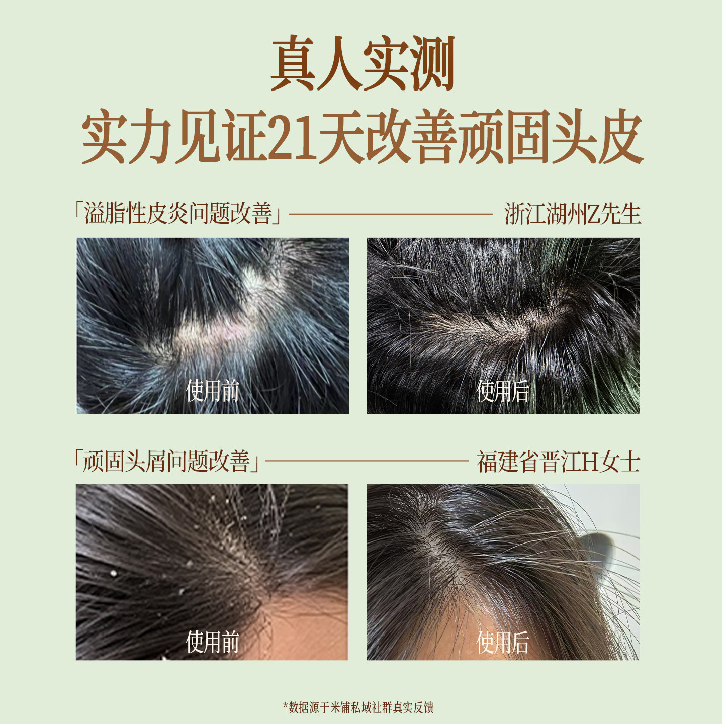 米铺沉香洗发水试用装小样控油蓬松去屑止痒改善干枯旅行装正品,淘宝优惠券,粉丝福利购,淘宝优惠卷