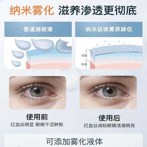 冷热双敷润眼仪舒缓眼睛疲劳熏眼器干眼症蒸眼仪雾化仪蒸汽护眼仪 - 图2