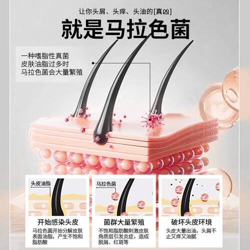 采乐 酮康唑洗剂 2%*100ml/瓶*1瓶/盒 去屑止痒 有效期2026年6月 - 图1
