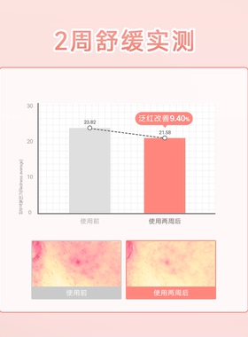 SkinFood思亲肤蜜桃清爽ZINC PCA控油精华50ml 深层补水平衡油脂