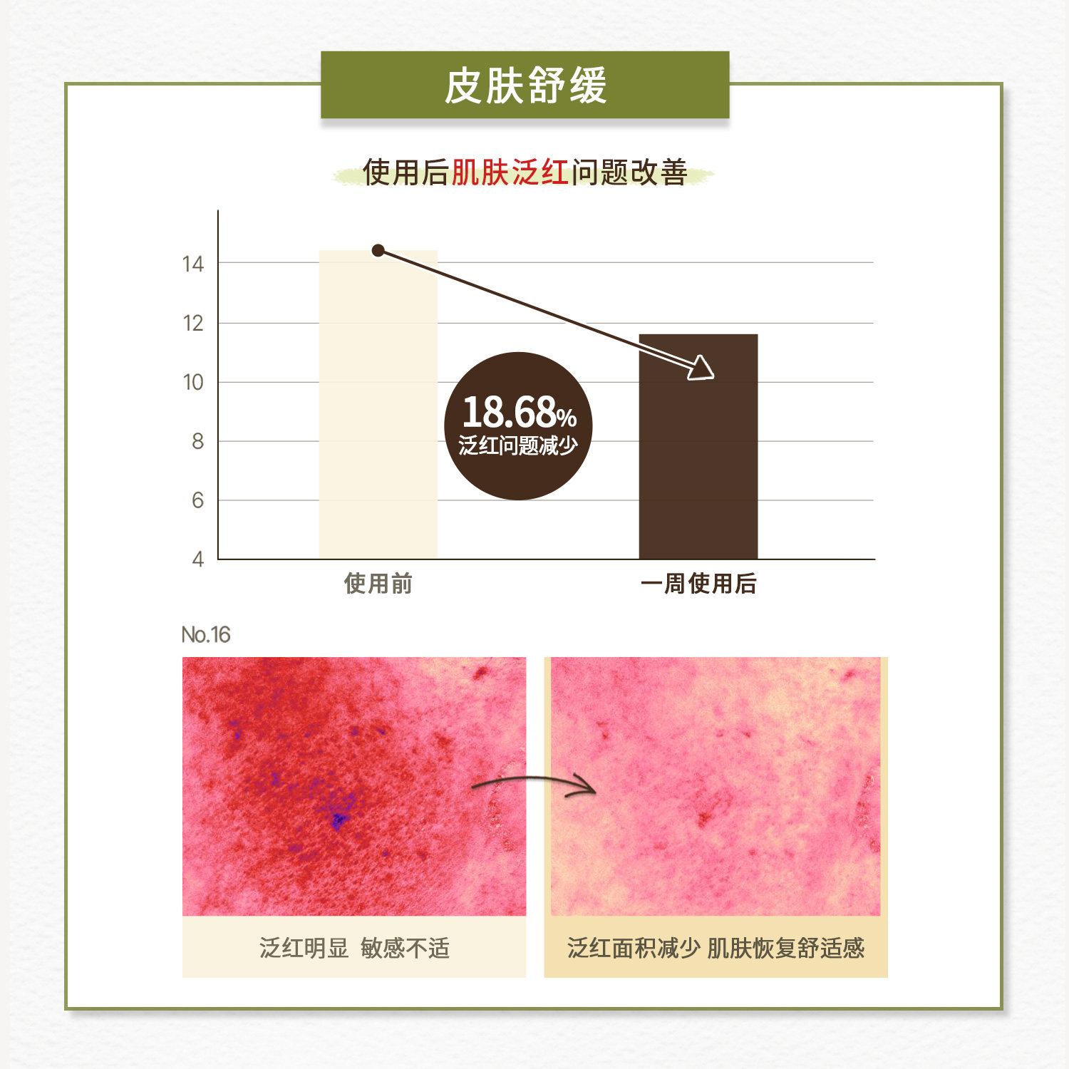 Skin Food/思亲肤胡萝卜棉片土豆积雪草60片即刻舒缓泛红敏感湿敷,淘宝优惠券,粉丝福利购,淘宝优惠卷