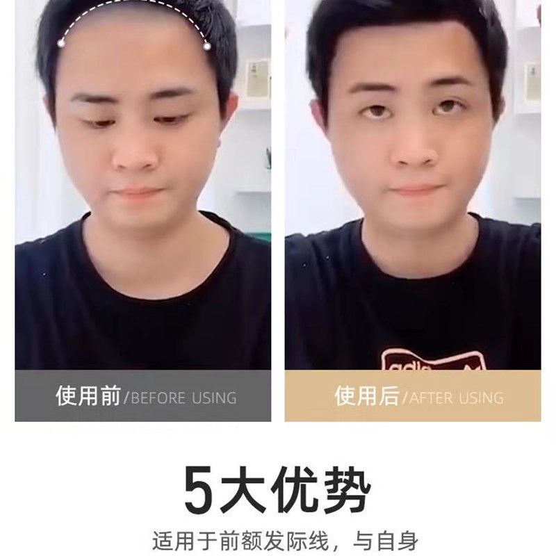 发际线假发贴男士刘海前额补发片自然隐形真发M型额头真人刘海片,淘宝优惠券,粉丝福利购,淘宝优惠卷