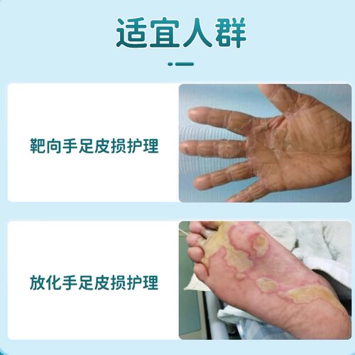手足综合征慧宁牌凝胶靶向化疗卡培副作用手脚发黑干裂脱皮疼 - 图1