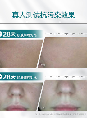 【米奇科宁专属C】安多可10%烟酰胺水光屏障舒缓精华南极发草30mL