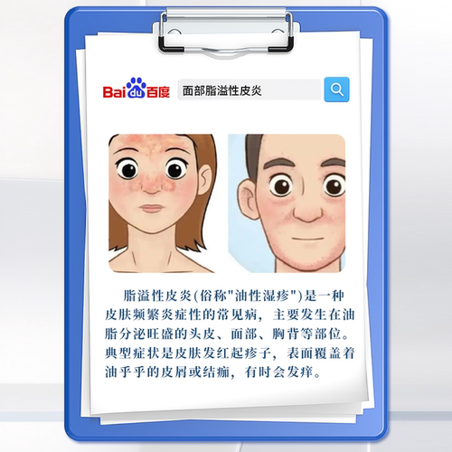 脸上部鼻子鼻翼两侧脂溢性皮炎面部修复护肤品软膏面霜马拉色菌QN - 图0