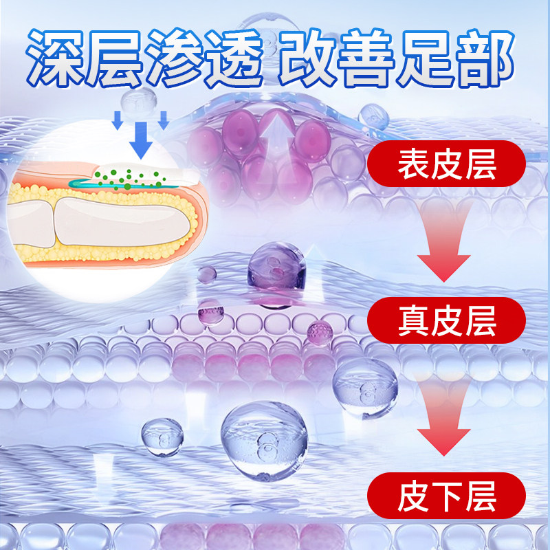 甲总管医用足部敷料甲宝玉凝胶灰指甲膏甲沟炎趾发黄变厚红肿痛痒,淘宝优惠券,粉丝福利购,淘宝优惠卷