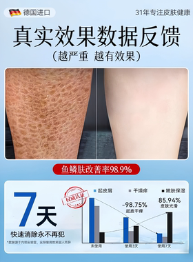 鱼鳞皮身体乳滋润肤乳