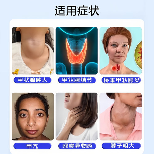 猫爪草胶囊散结节消除甲减甲状腺结节功能减退甲亢突眼特效中成药 - 图2