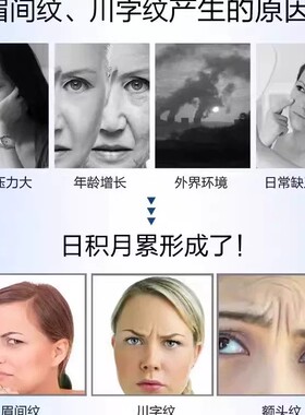 纯物理去川字纹眼角纹⭐日本材料