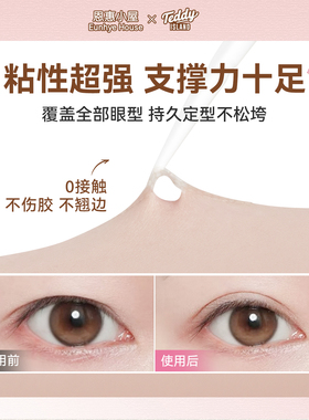 恩惠小屋双眼皮隐形自然