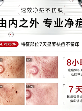碧诺斯清颜净肤精华液控油收毛孔