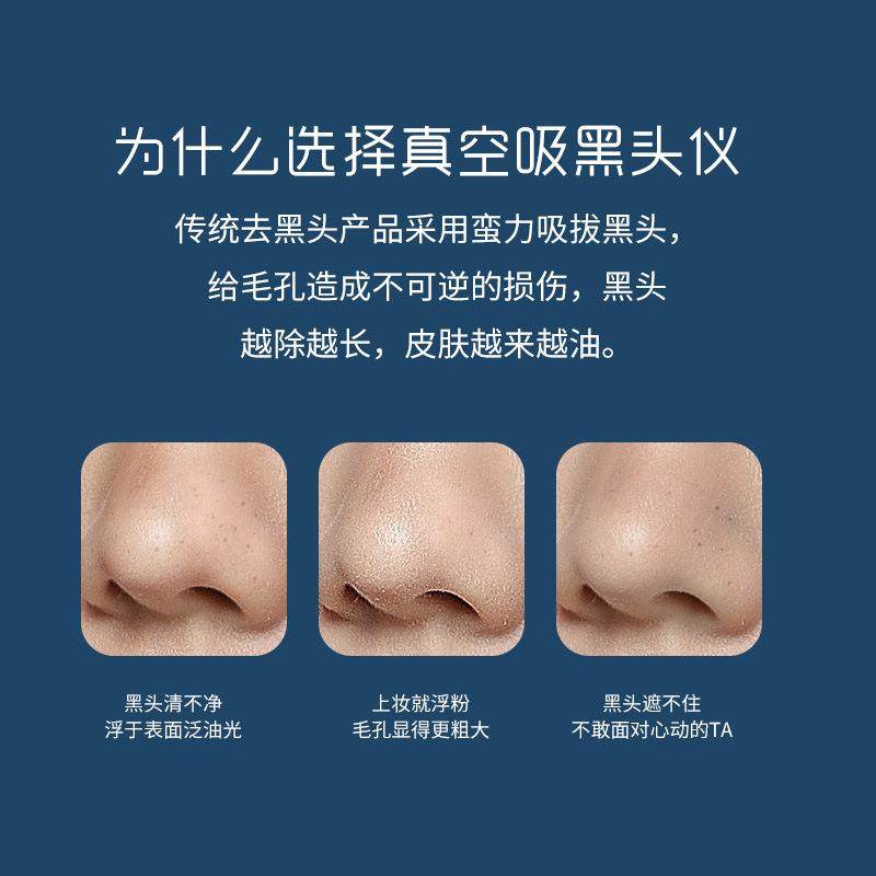 热销吸黑头仪电动美容仪神器祛粉刺黑头按摩洁面毛孔清洁器,淘宝优惠券,粉丝福利购,淘宝优惠卷