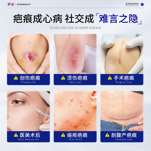 葵花疤痕贴医用儿童专用术后伤口防水增生减张硅酮凝胶小孩祛疤贴 - 图0