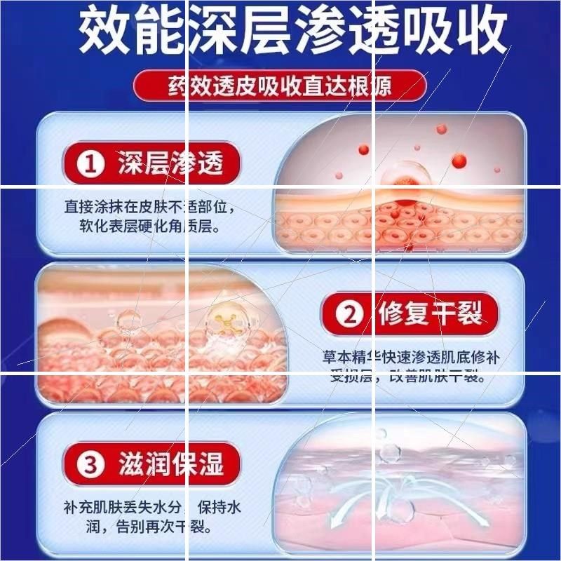 宫本武藏皴裂膏皲裂膏手部脚后跟防干裂脚裂手足霜,淘宝优惠券,粉丝福利购,淘宝优惠卷