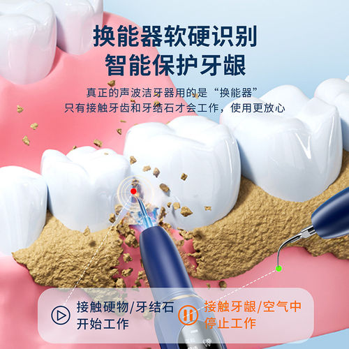 进口超声波家用洁牙器洁牙除牙结石清除牙齿污垢安全护齿神器 - 图3