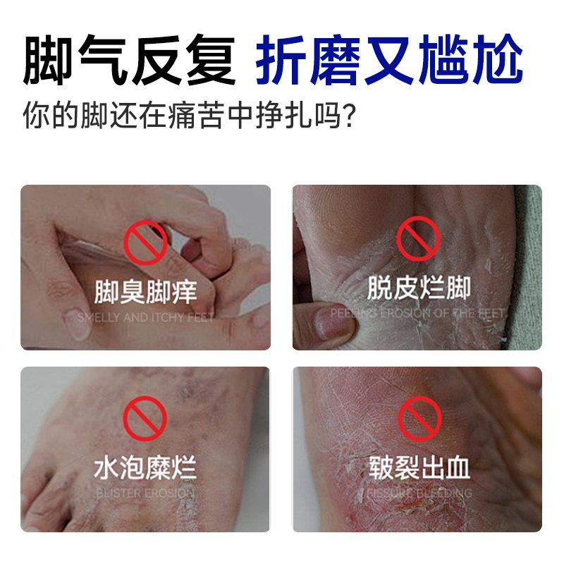 LAPOR脚气王脚臭脚气脚痒烂脚丫皮肤瘙痒抑菌外用软膏20g/盒A