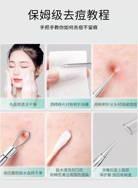 【赠送收纳盒】美容店专用细胞夹美容针粉刺夹粉刺针黑头痘痘针QQ