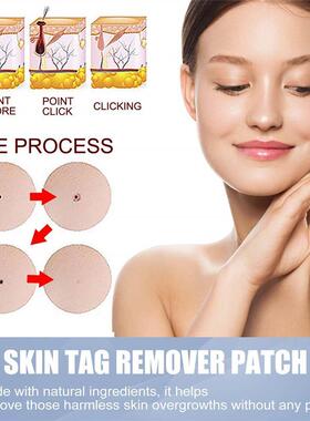 144Pcs Skin Tag Remover Patches Mole Wart Removing Sticker N