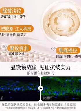 【韩国明星同款】透明质酸钠抗皱睡眠纹贴细纹法令纹抗皱贴正品