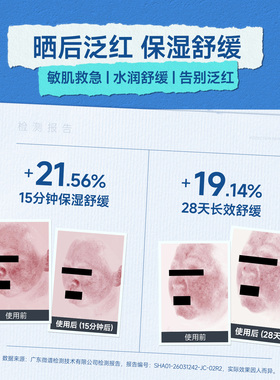 【抗蓝光精华喷雾】抚迹精华喷雾补水保湿舒缓妆前喷雾女60ml