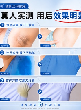 她可手汗症神器氯化羟铝止汗腋下多汗去手心出汗脚汗除手足喷雾