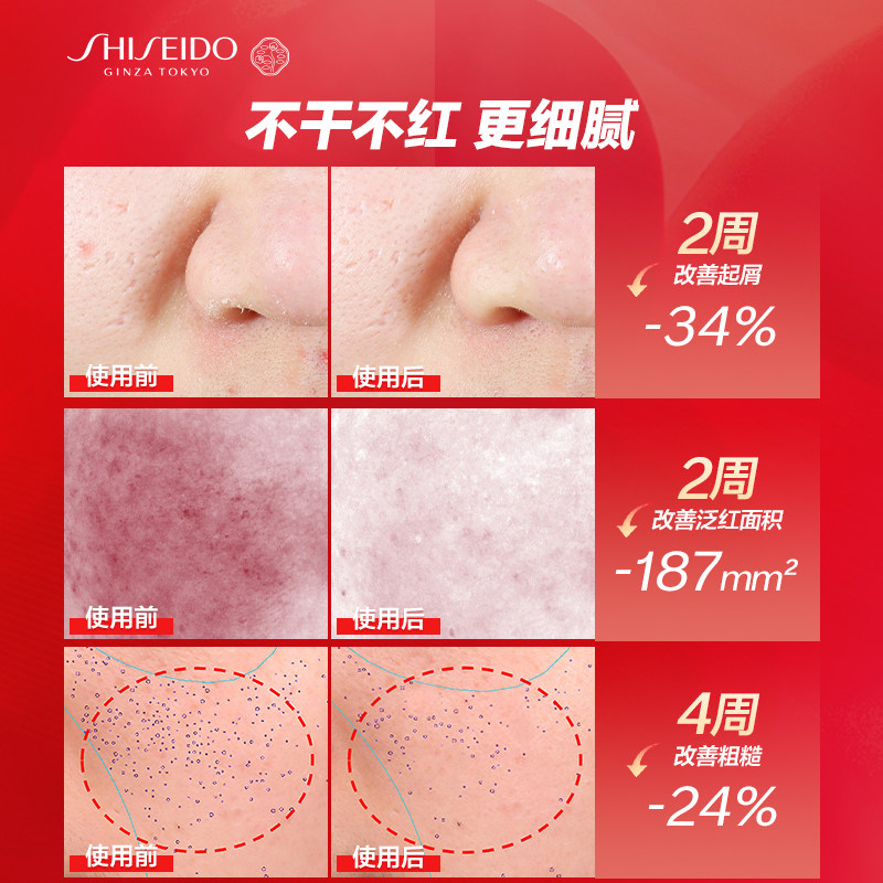 【双11立即付定】资生堂红妍肌活红腰子精华液面部紧致保湿护肤品