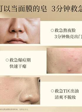 瑞典蛋清面膜洁面皂控油祛痘卸妆