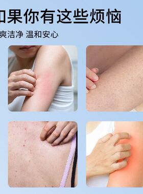 炉甘石皂可用肤康皂香皂沐浴全身