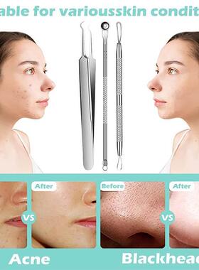 Blackhead Remover Tools Pimple Popper Tool Kit Acne